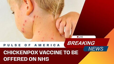 Chickenpox vaccine to be offered on NHS next year as part of routine MMR jab for babies