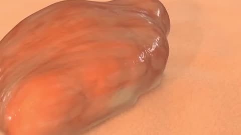 How Your Body Heals Cuts Scrapes and Puncture Wounds to the Skin