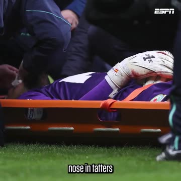 Why does Arsenal's goalkeeper look different than in 2018? A terrible nose injury is to blame