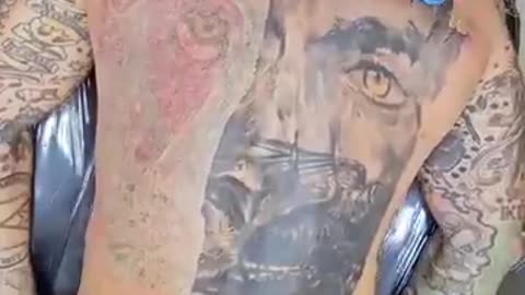 Time Lapse of Tattoo Removal by Laser