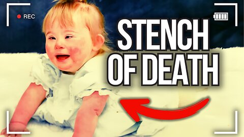 Mom Lets Disabled Daughter Get Devoured By Scabies
