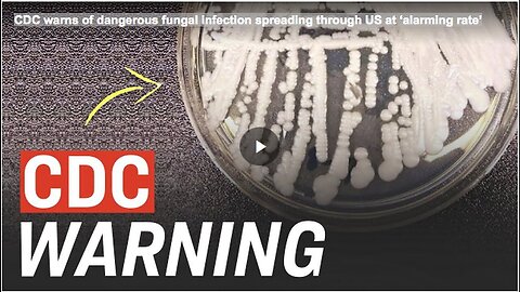 "Alarming Spread of Dangerous Fungal Infection Across US, Warns CDC"