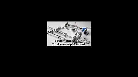 Total knee replacement #Bones#BoneHealth#BoneCare#StrongBones#BoneStrength#BoneHealing#BoneInjury