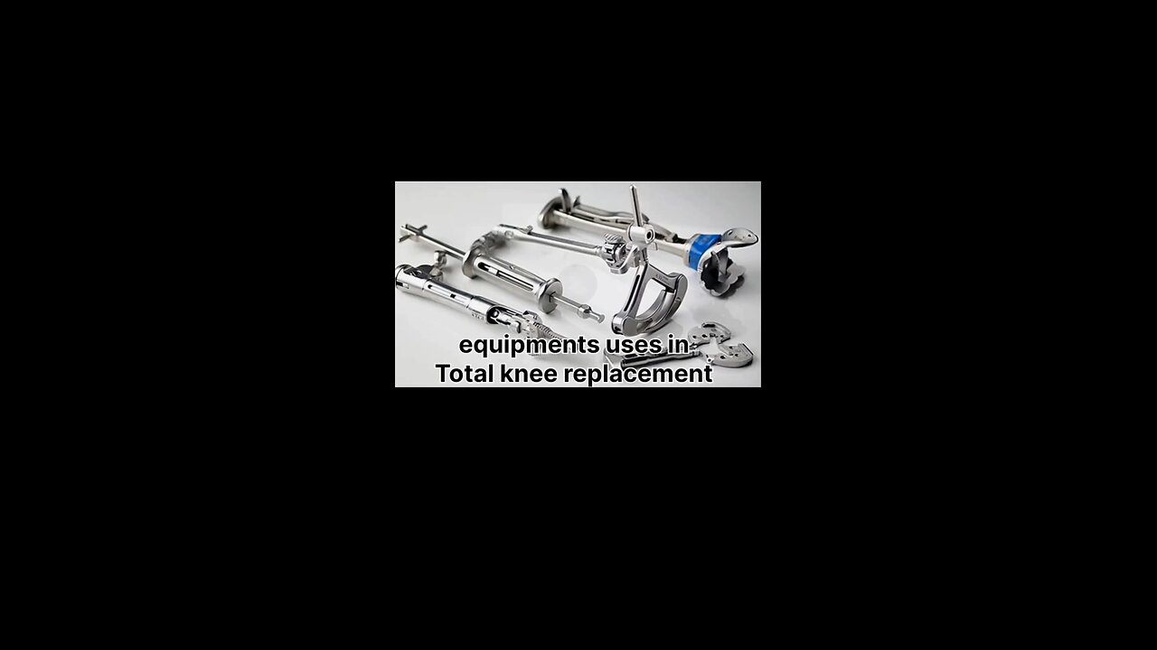 Total knee replacement #Bones#BoneHealth#BoneCare#StrongBones#BoneStrength#BoneHealing#BoneInjury