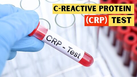C-Reactive Protein (CRP) Test - Everything You Need To Know! MD24