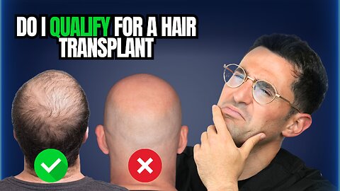 FAQ: Do I Qualify for a Hair Transplant? Here’s What You Really Need to Know!