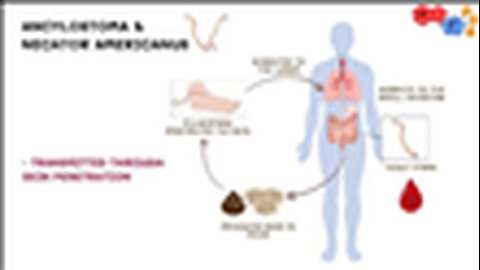 "Unveiling the Threat: Using Helminths in Bioterrorism - A Detailed Analysis"