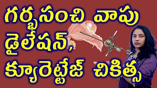 గర్భసంచి వాపు డైలేషన్ క్యూరెట్టేజ్ చికిత్స Bulky Uterus Dilation & curettage (D&C) Treatment Process