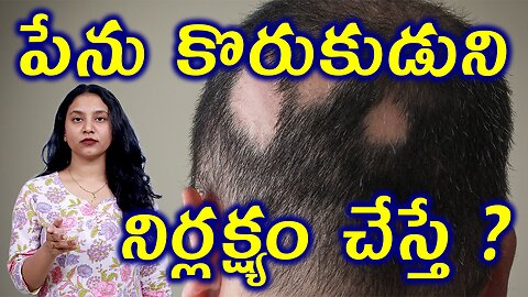 పేను కోరుకుడుని నిర్లక్ష్యం చేస్తే Neglect Complication of AlopeciaAreata or SpotBaldness Homeopathy