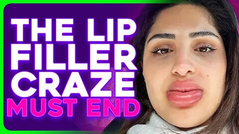 Women Are Removing Lip Filler in SHOCKING Numbers