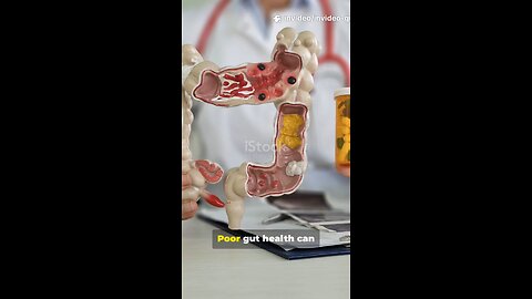 Gut Health & Antidepressants | Why Bacteria Matter