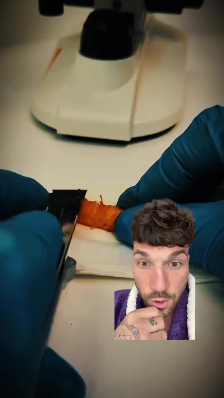 These are Cheetos 🤢under a microscope