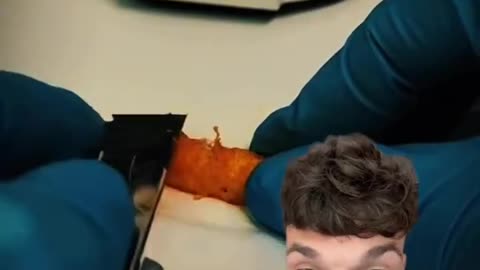 These are Cheetos 🤢under a microscope