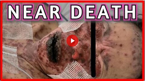 VACCINE NEARLY KILLS WOMAN - THE MEDIA WON'T SHOW THIS