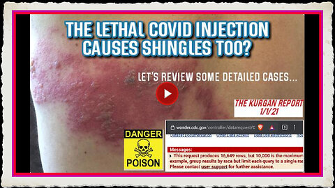 WHAT DID I FIND WHEN SEARCHING VAERS COVID INJECTIONS INVOLVING SHINGLES
