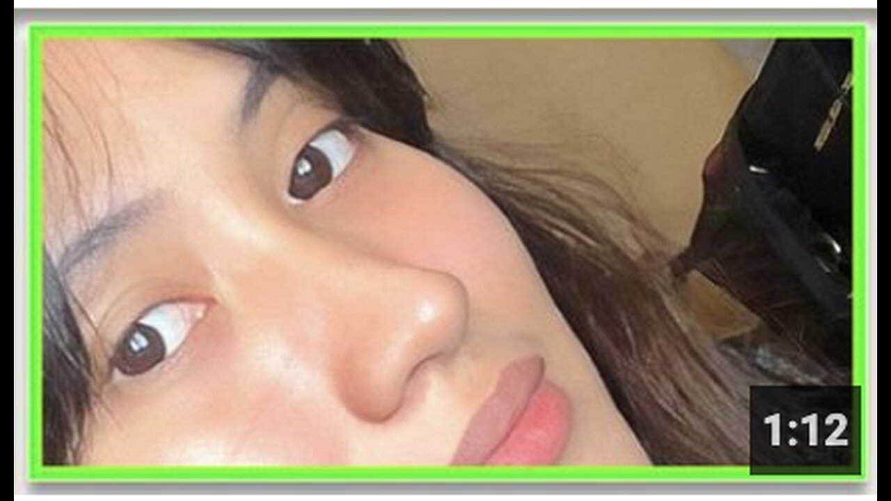 "Pfizer Vaccine Allegedly Causes Severe Breast Damage Leading to Mastectomy"