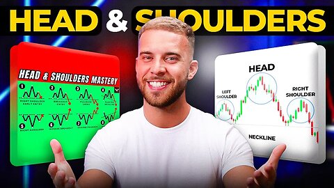 How I spot forex patterns that print money