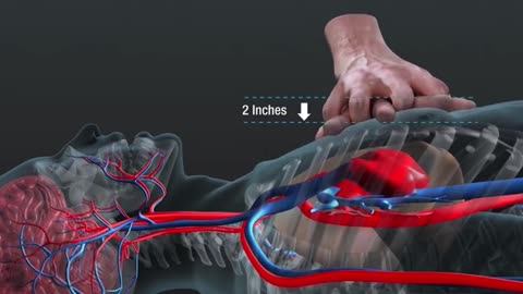 Life Saving Procedure Cardiopulmonary resuccitation (CPR)