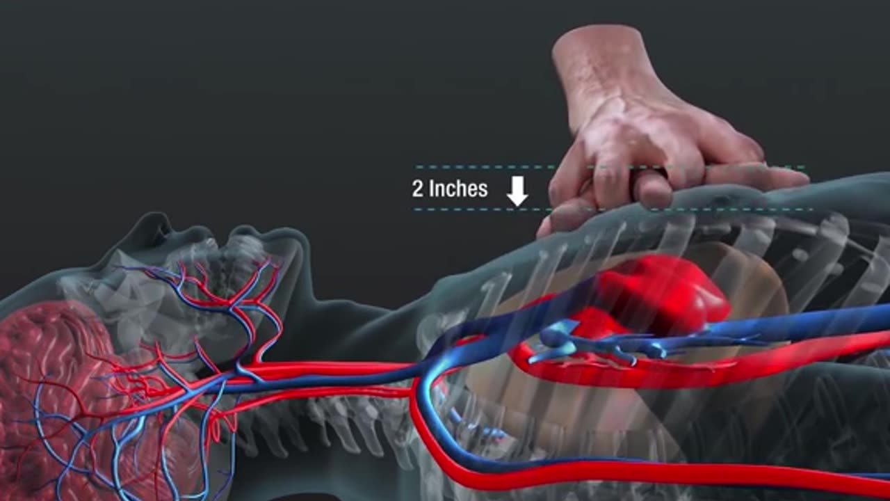 Life Saving Procedure Cardiopulmonary resuccitation (CPR)