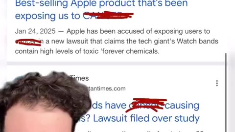 Do you wear an Apple Watch? Have you noticed a mark develop on your skin?