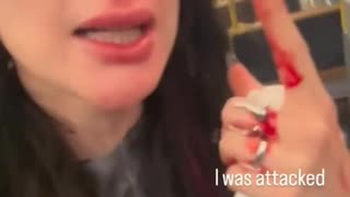 The usual suspect in Zurich tries to rob a defenseless woman and then beats her.