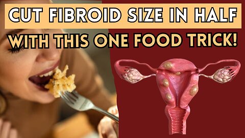 Shrink Fibroids FAST With This ONE Simple Trick (Doctors Hate This!)