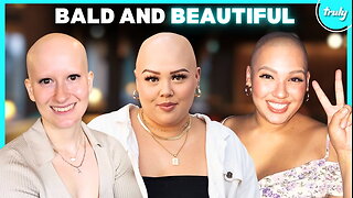 We’re Bald & Beautiful - Will Our Blind Dates Agree? | DATING DIFFERENT