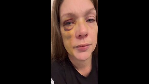The Cincinnati woman attacked by a mob has broken her silence, revealing she’s still suffering