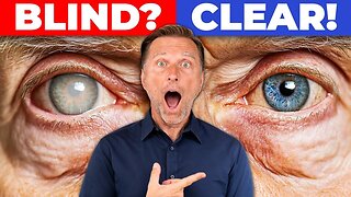 "Dr. Eric Berg: (Cataracts) DONT IGNORE THIS IF YOURE OVER"