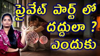 ప్రైవేట్ పార్ట్ లో దద్దులా Why Private Part Rashes Keep Coming Back? | Genital Herpes Homeopathy