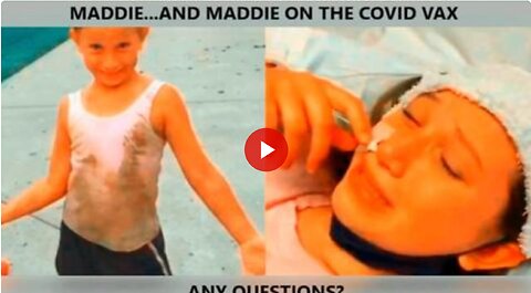 A comparison. Parents need to wake up. Your child. Your child on the covid vaccine. Questions?