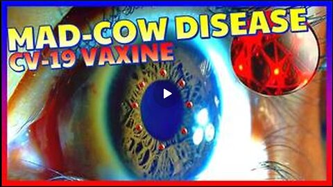 Mad cow (prion) disease will affect millions of people who have taken the CV-19 toxic injection