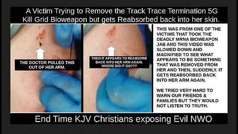 A Victim Trying to Remove the Track Trace Technology