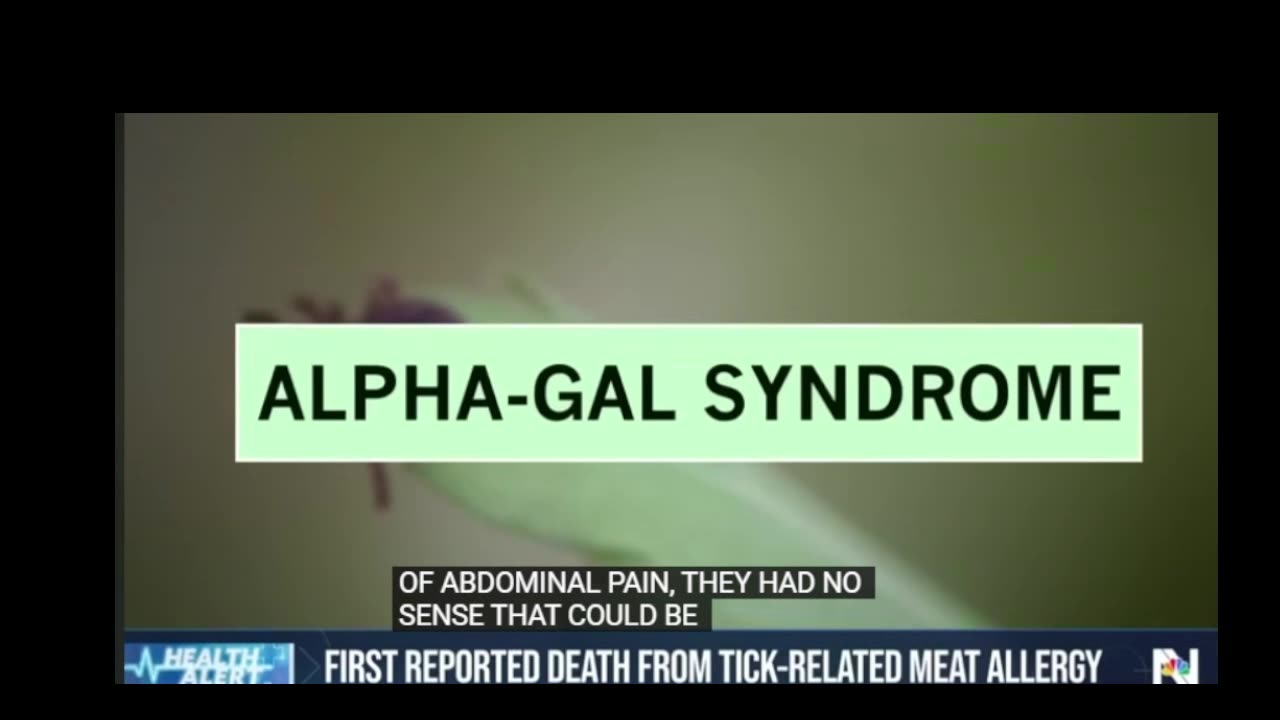 Alpha-Gal Syndrome