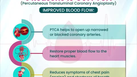 5 Reason to Get Percutaneous Transluminal Coronary Angioplasty
