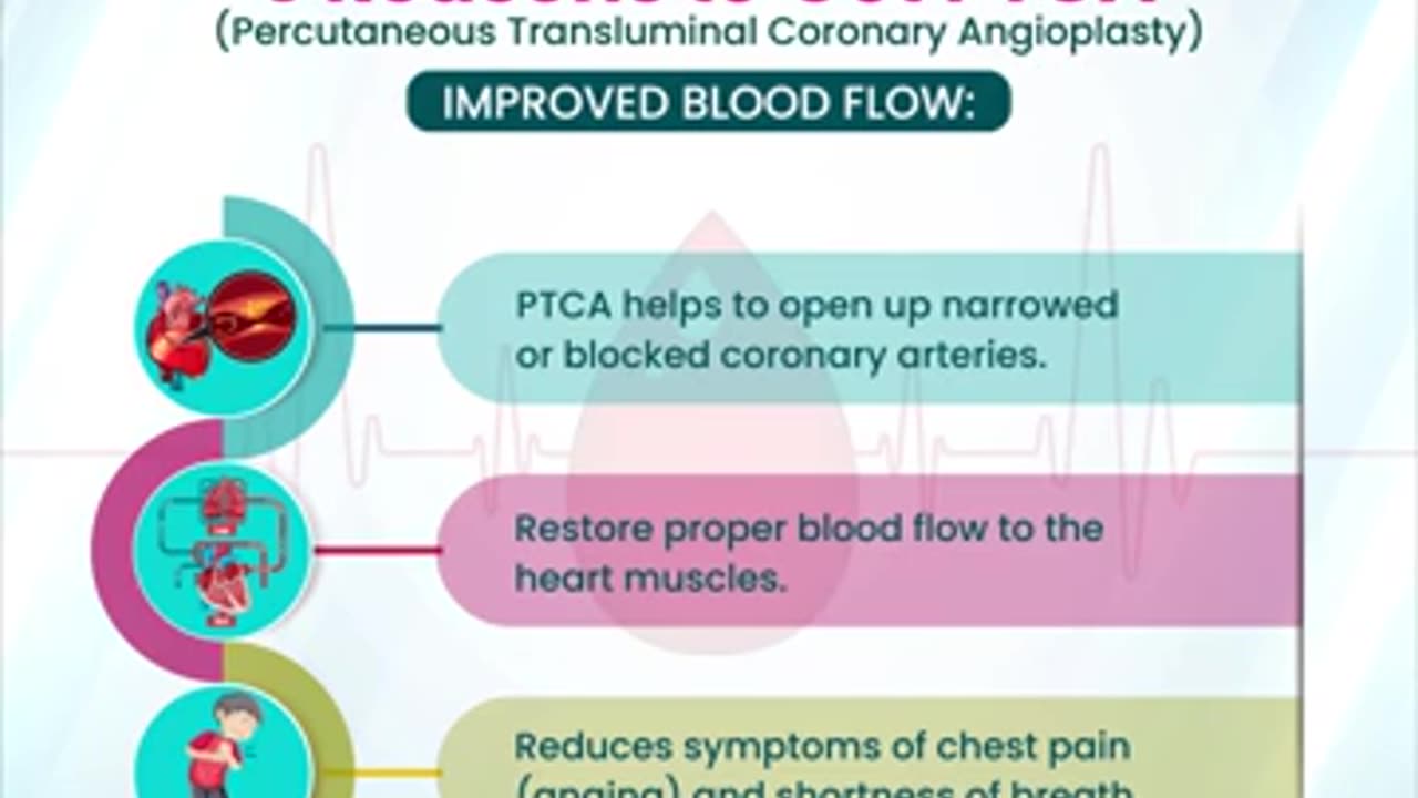 5 Reason to Get Percutaneous Transluminal Coronary Angioplasty