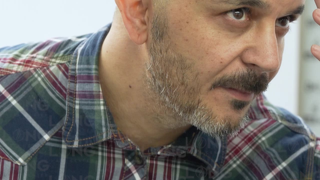 If you are looking for a fine hair transplant, we would be delighted to help you find what you