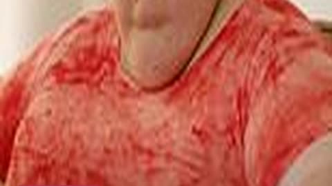 1000lb Sisters Star Tammy Slatons New Shrinking B