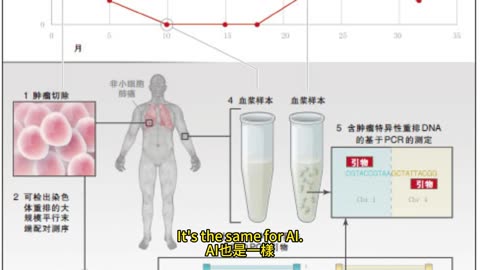 逆轉慢性腎衰竭 補水運動護腎