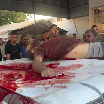 This is part of the pain that the people of Gaza suffer