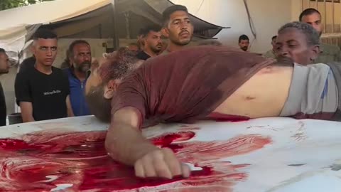 This is part of the pain that the people of Gaza suffer