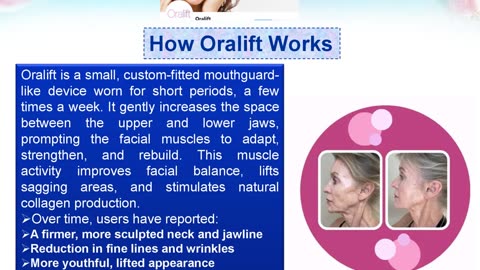 Cosmetic Dentistry and Neck Tightening, Reimagined with Oralift
