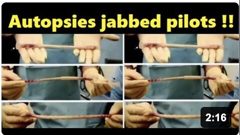Autopsies of jabbed pilots -Dr. Robert Young