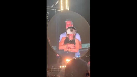 Don't get caught at the Coldplay concert with a bad hairline.