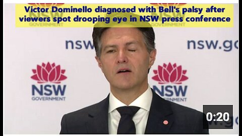 "NSW Press Conf. Viewers Spot Drooping Eye, Leading to Victor Dominello's Bell's Palsy Diagnosis"