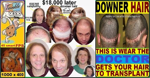 The Brooklyn Crushers hair transplants $10,500 9-25-2000 & $7,500 10-10-2002