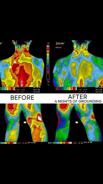 "Grounding" your bare feet to the earth's electromagnetic field with a natural frequency of 7.83 hertz protects all living things