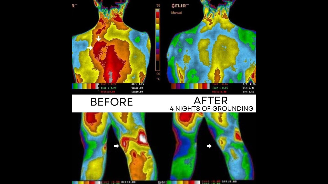 "Grounding" your bare feet to the earth's electromagnetic field with a natural frequency of 7.83 hertz protects all living things