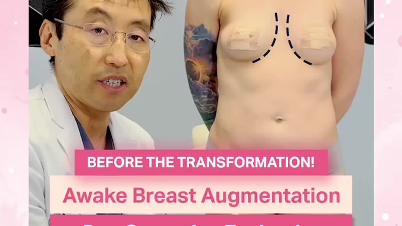 Awake Breast Augmentation Pre-Op Evaluation with Dr. Kenneth Kim Part 1