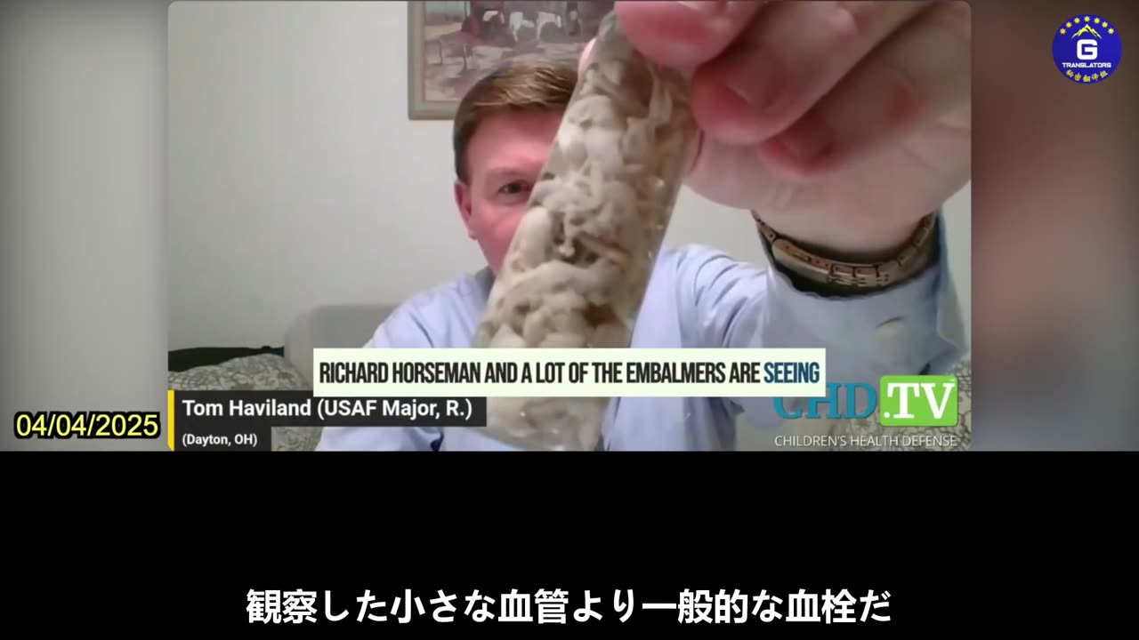 【JP】2024年、83％のエンバーマーが剖検で白色繊維状血栓を確認